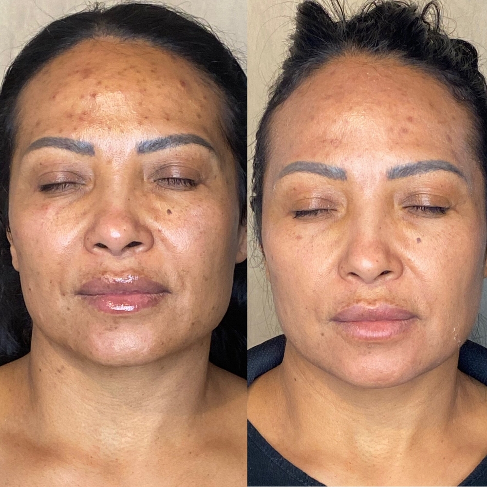 Customize My Facial Deluxe