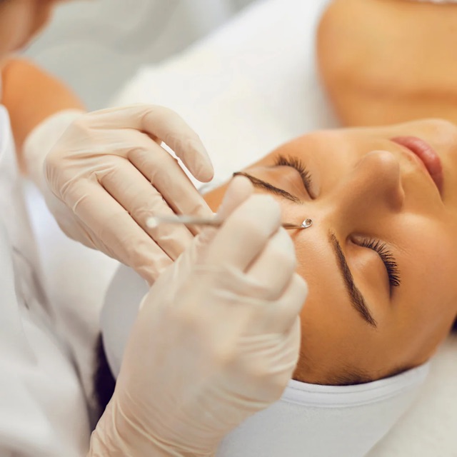 Acne Facial