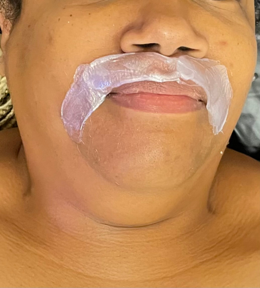 Upper Lip Waxing