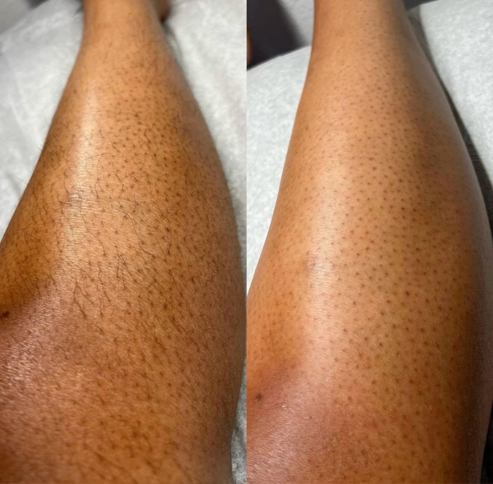 Leg Wax (Half)