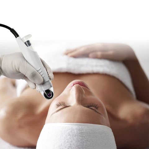 Microneedling at Jordyn Sprague, Esthetician in Roscommon, MI