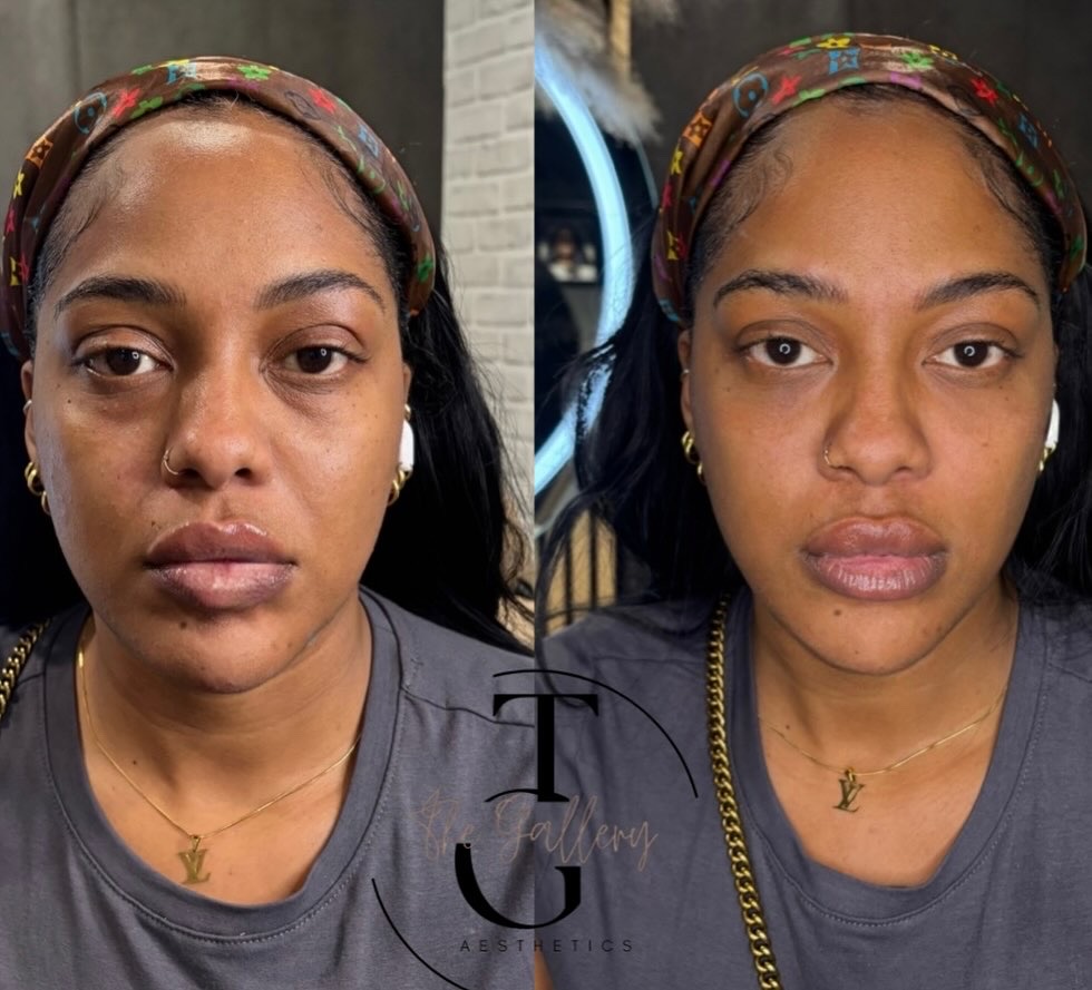 Facial Balancing Consultation