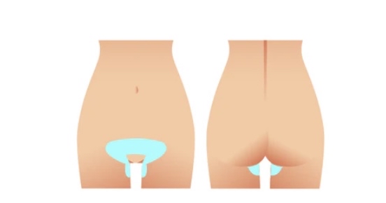 Full Brazilian No Butt