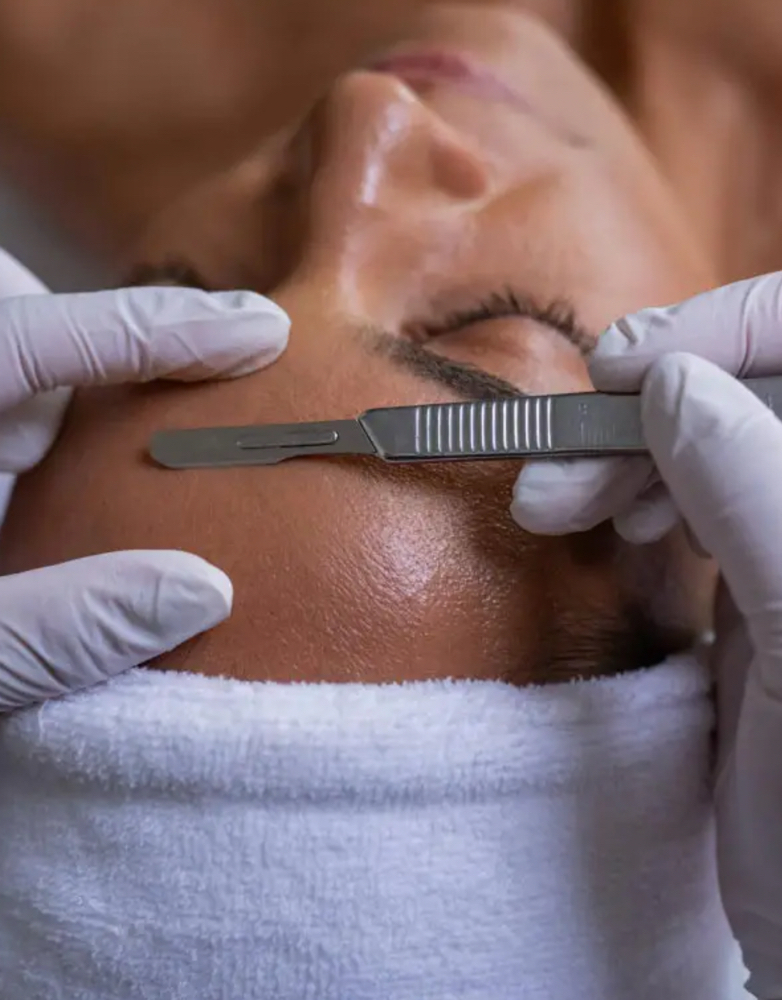 Dermaplane Add On