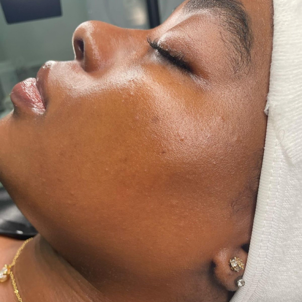 Full Face Wax at LauLux Esthetics in Bellerose, NY