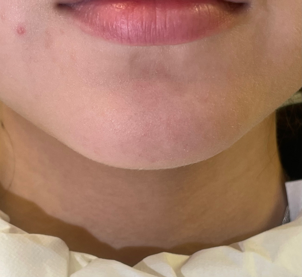 Chin Wax