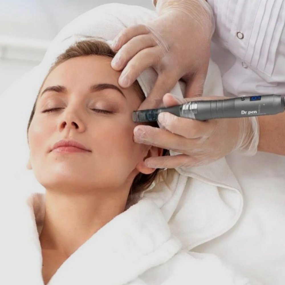 Single Microneedling session at Yampa Glow Aesthetics in STEAMBOAT SPR, CO