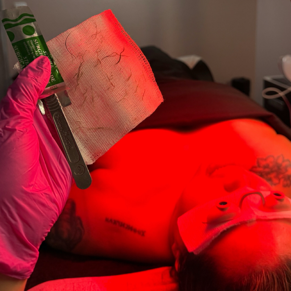 Dermaplaning Upgrade at Jassed Up Beauty in Las Vegas Nevada, NV