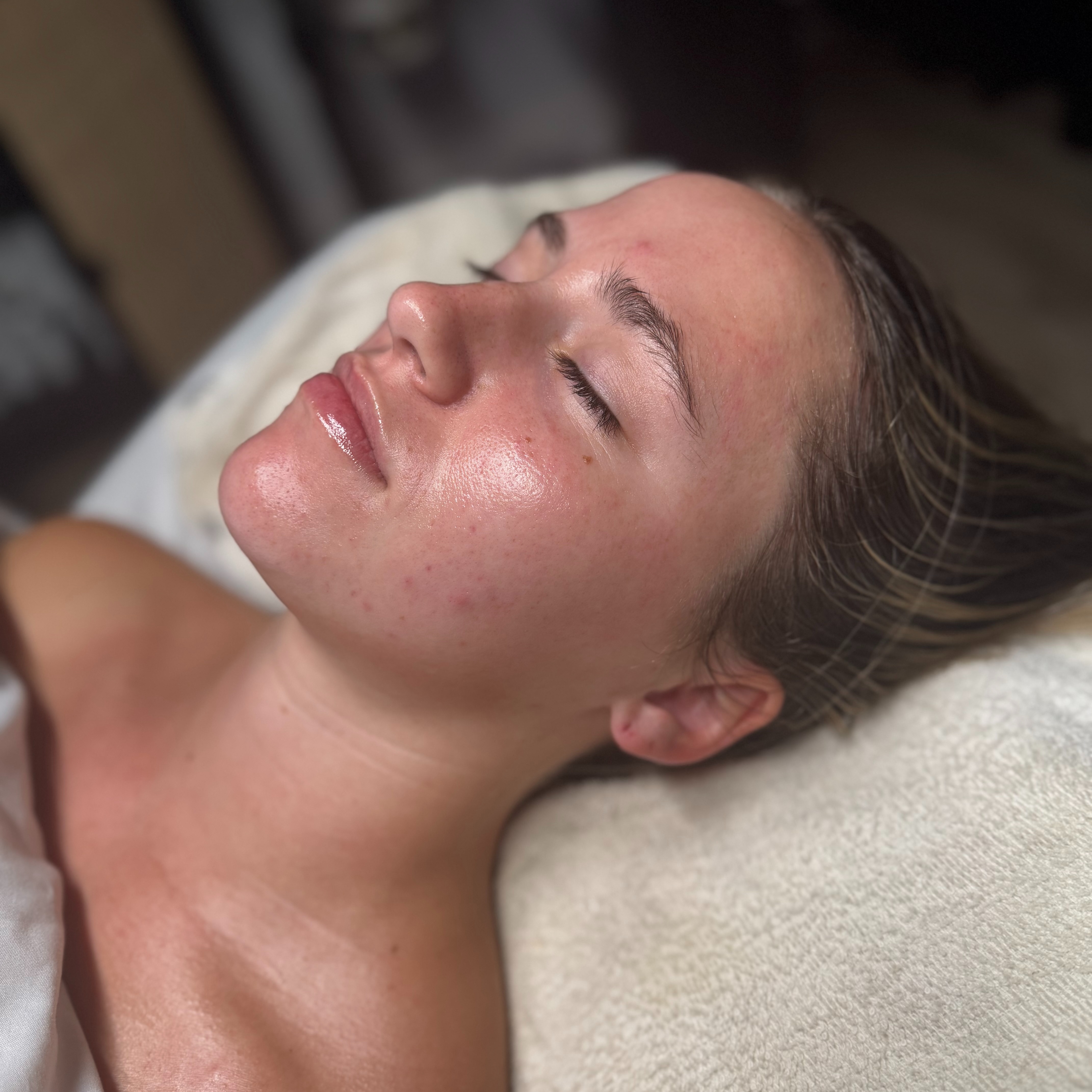 Oxygen Treatment at The Skin Edit LLC in Gulf Shores, AL