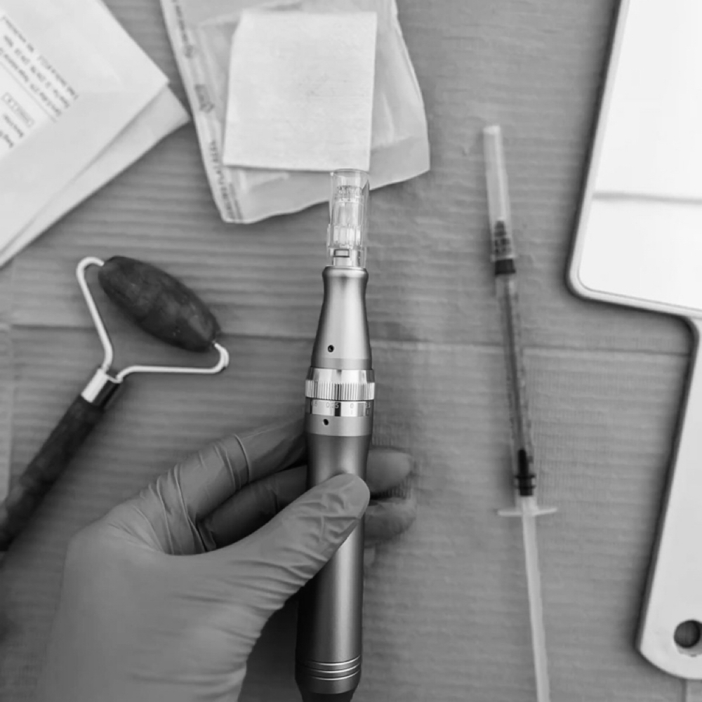 MICRONEEDLING at LCA Esthetics in Pierceton, IN