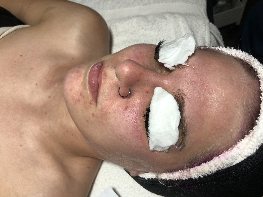 Sensitive Skin Rescue