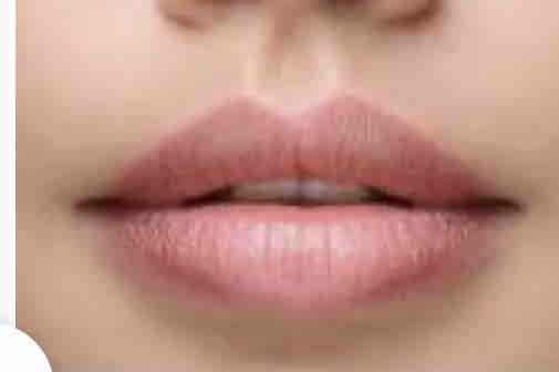 Fix Lip Treatment