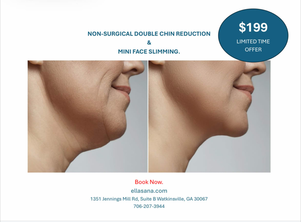 Chin Reduction Limited Time Promo