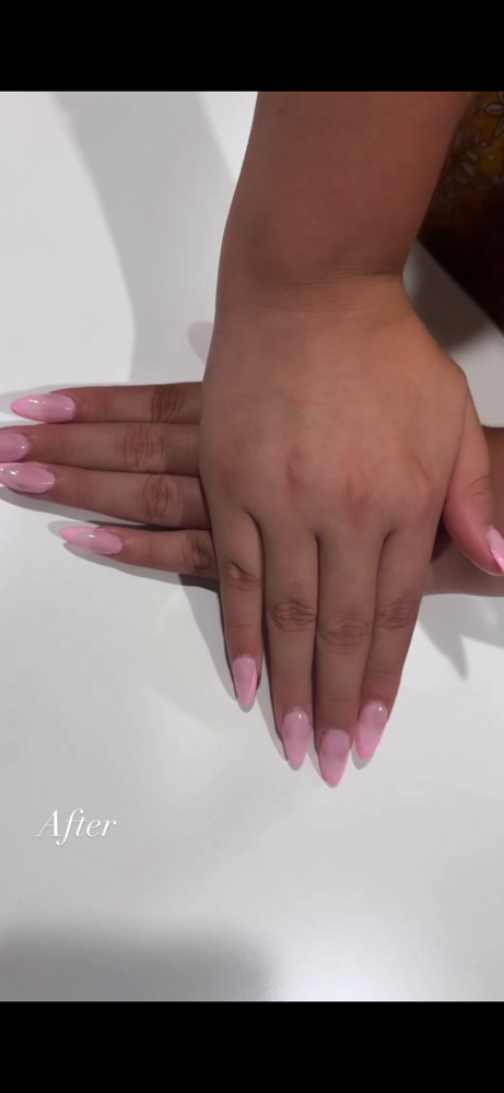 Gel X