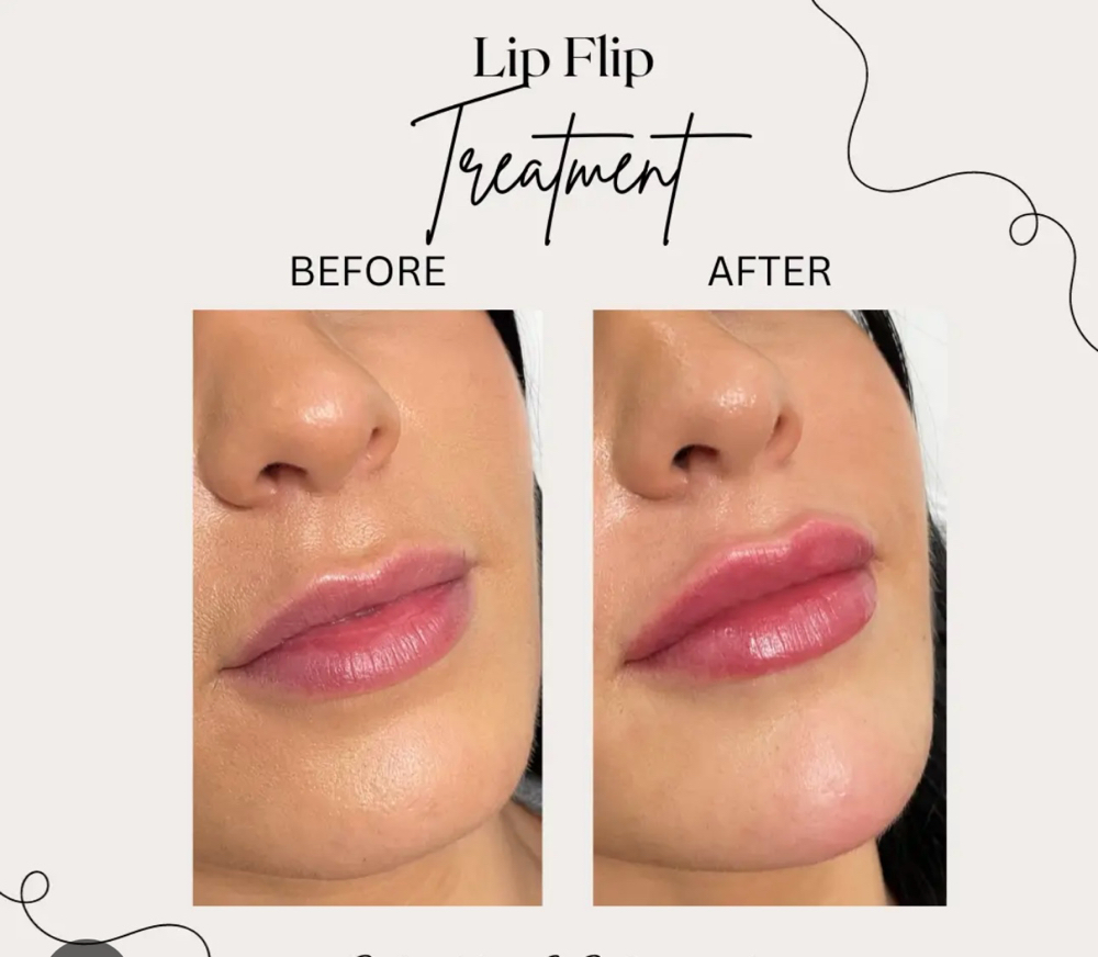 Lip Flip