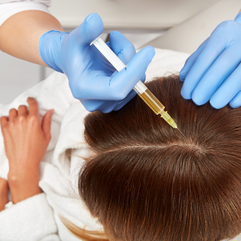 PRP Hair Restoration at Revive Wellness in El Paso, TX