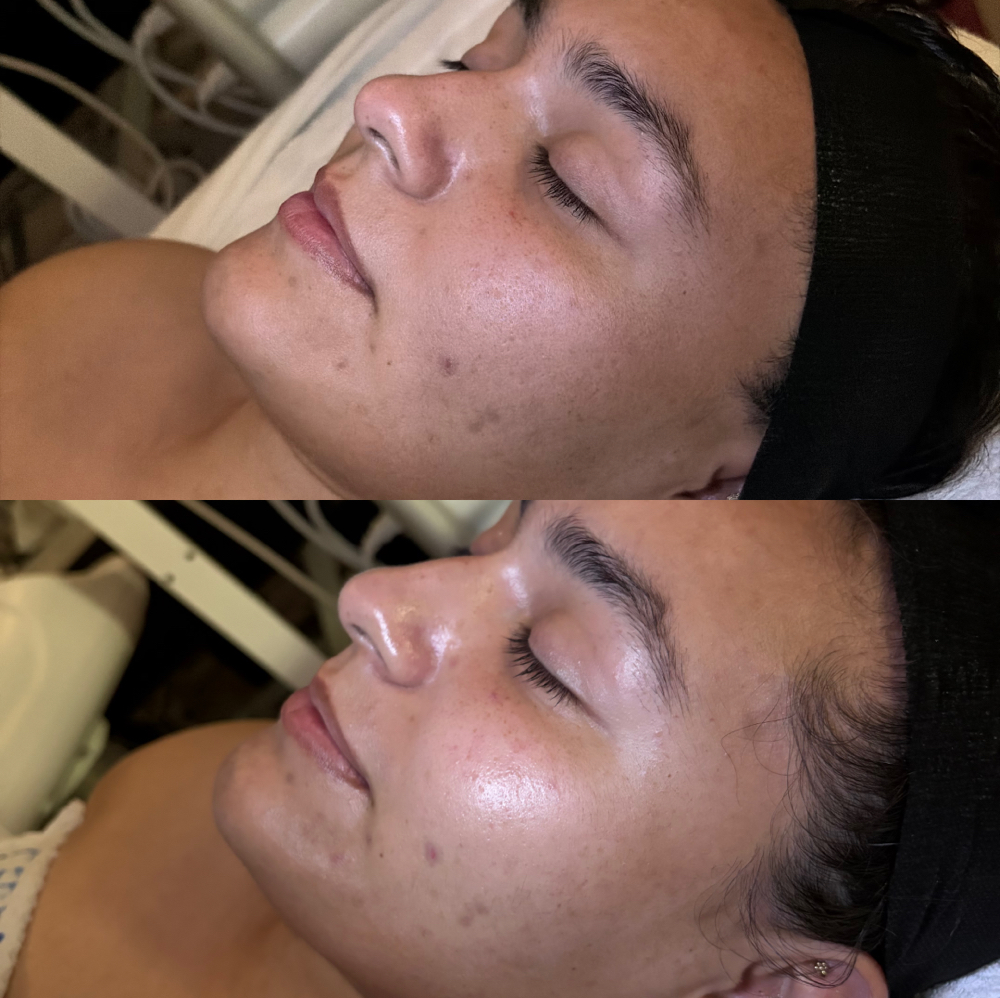 Signature Custom Facial at Vintage Kitty Esthetics in Los Angeles, CA