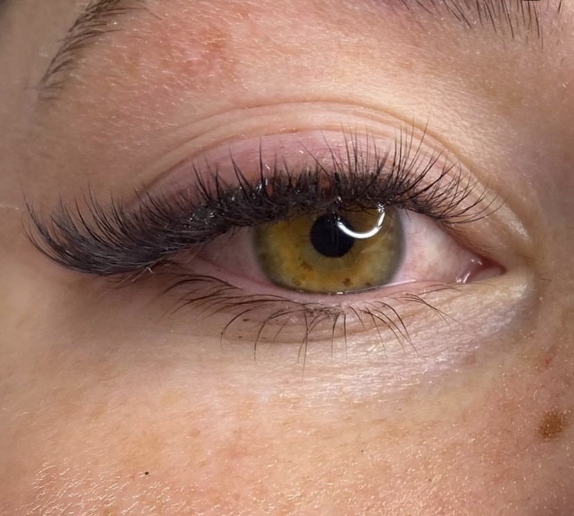 Lash Consult/patch Test