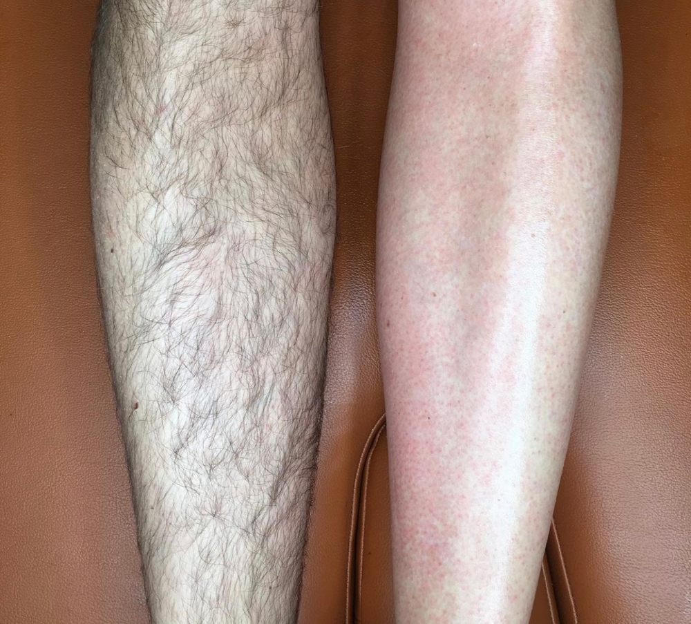 Full Leg Wax