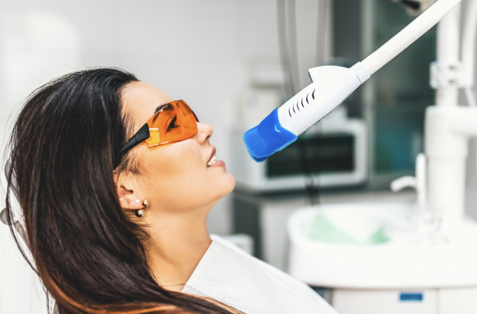 Sparkle Teeth Whitening 40 Min