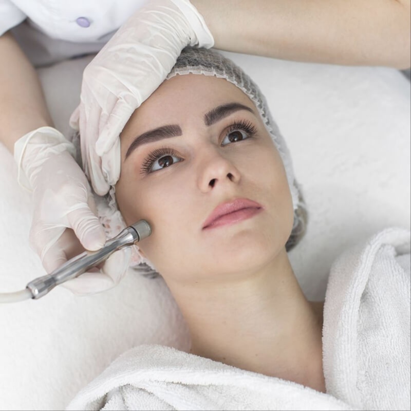 Microdermoabrasión at Irines Spa in Roanoke, VA