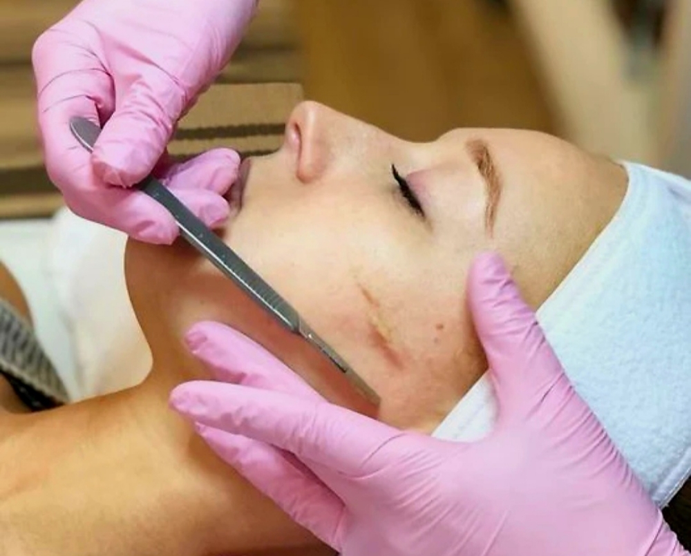 Dermaplaning Facial