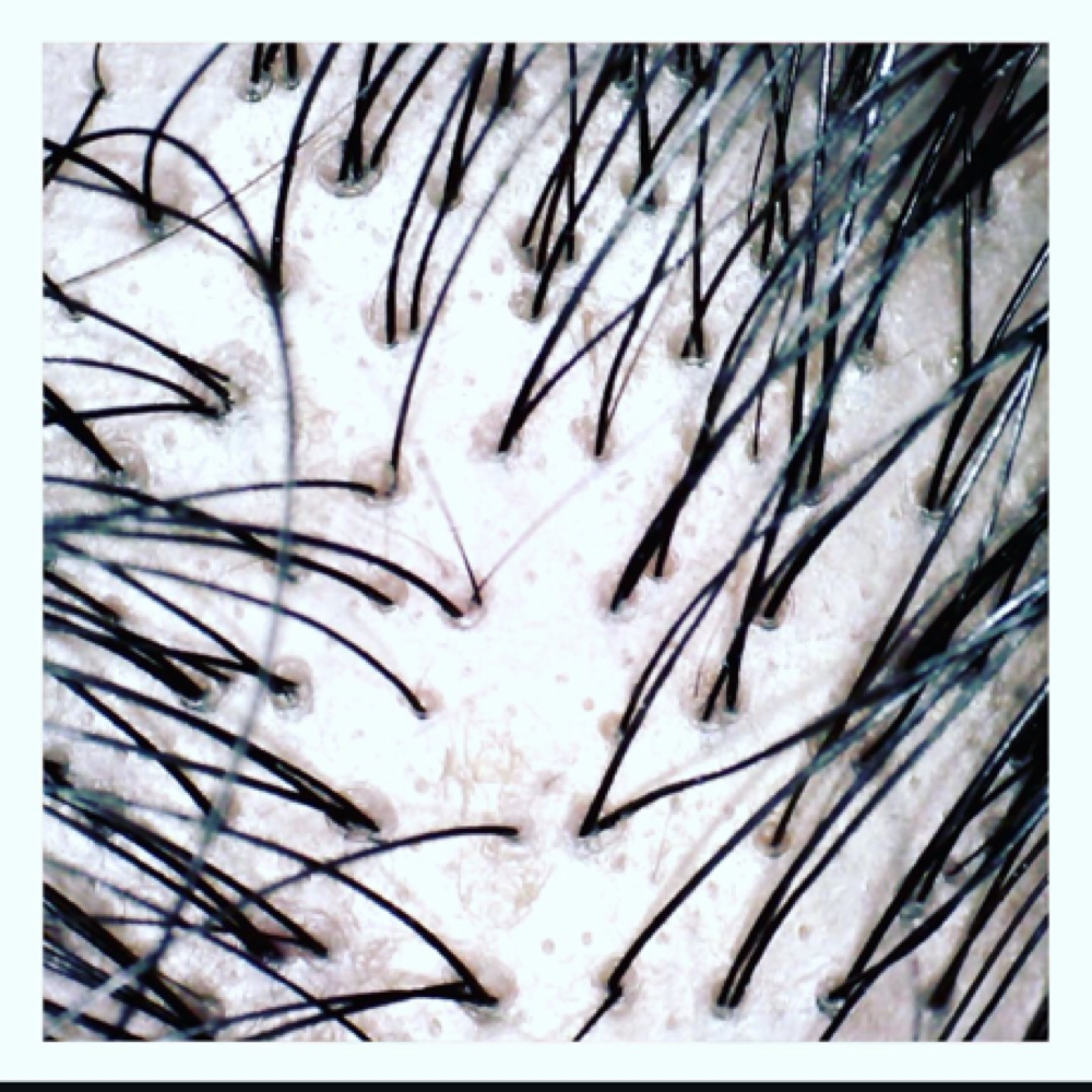 Scalp +Hair Analysis Consultation at Reiss Beauty by Renée Bradlee in La Mesa, CA