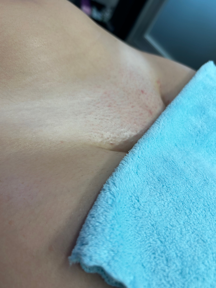 Brazilian wax