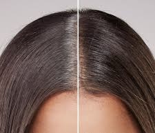 Root Retouch