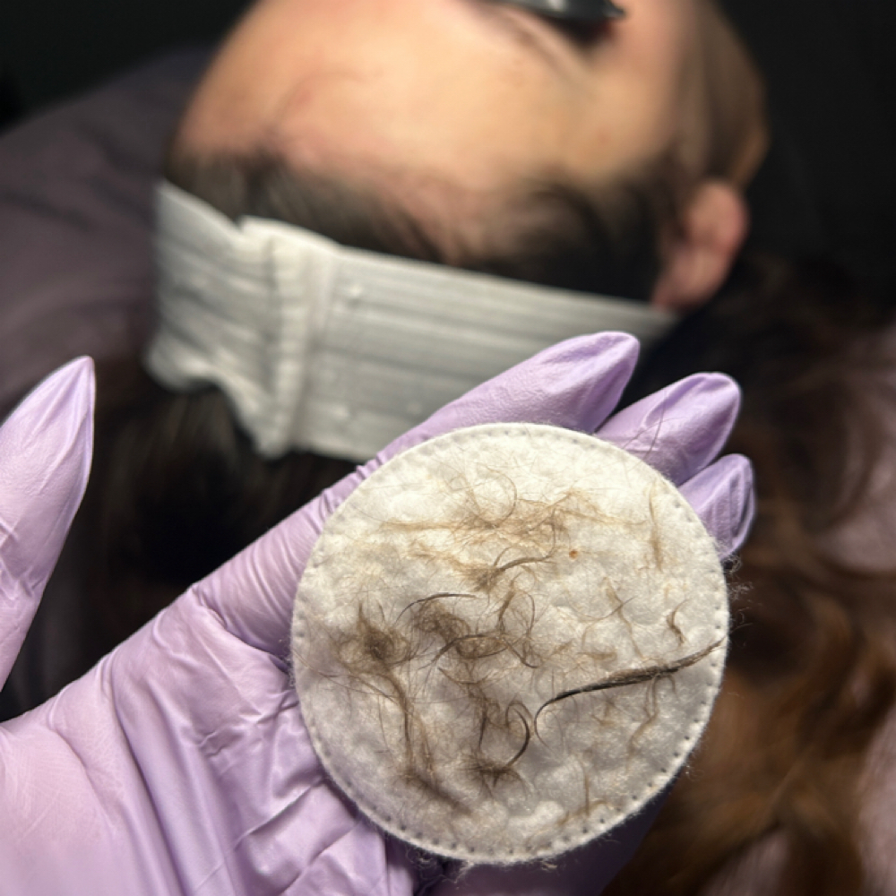 Dermaplane Add-On at Love, Daisy in Apple Valley, CA