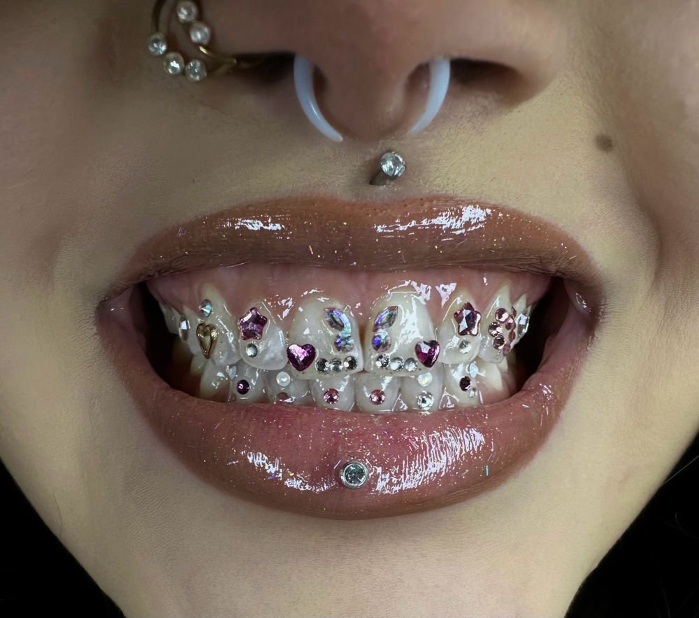 Iced Out Set (Whole Mouth)