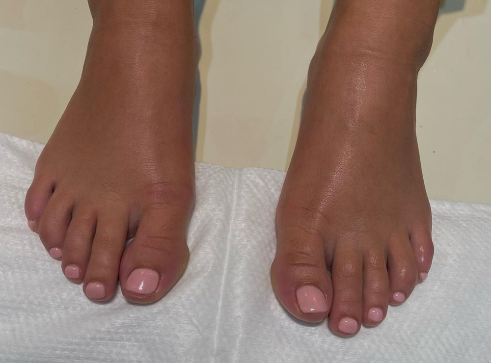 Pedicure