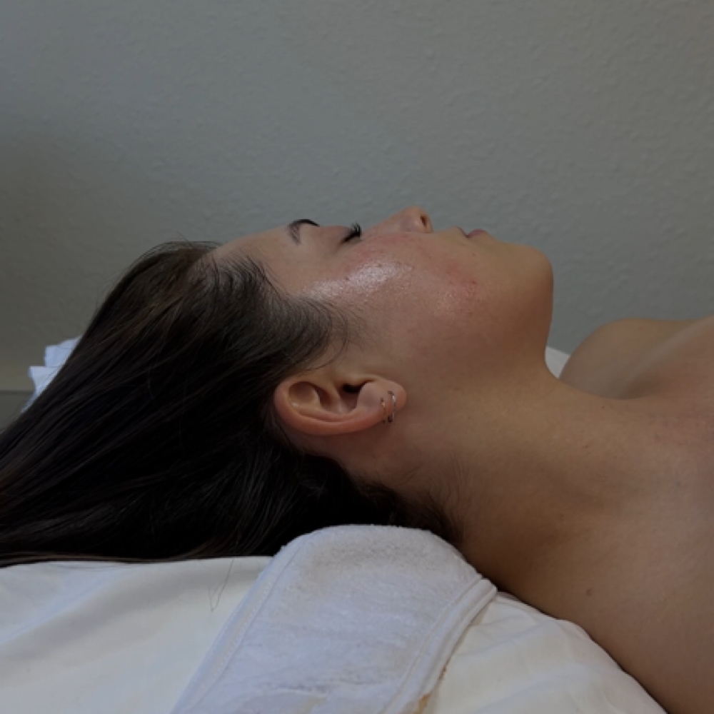 Acne Bootcamp at Baire Skin Spa in Visalia, CA
