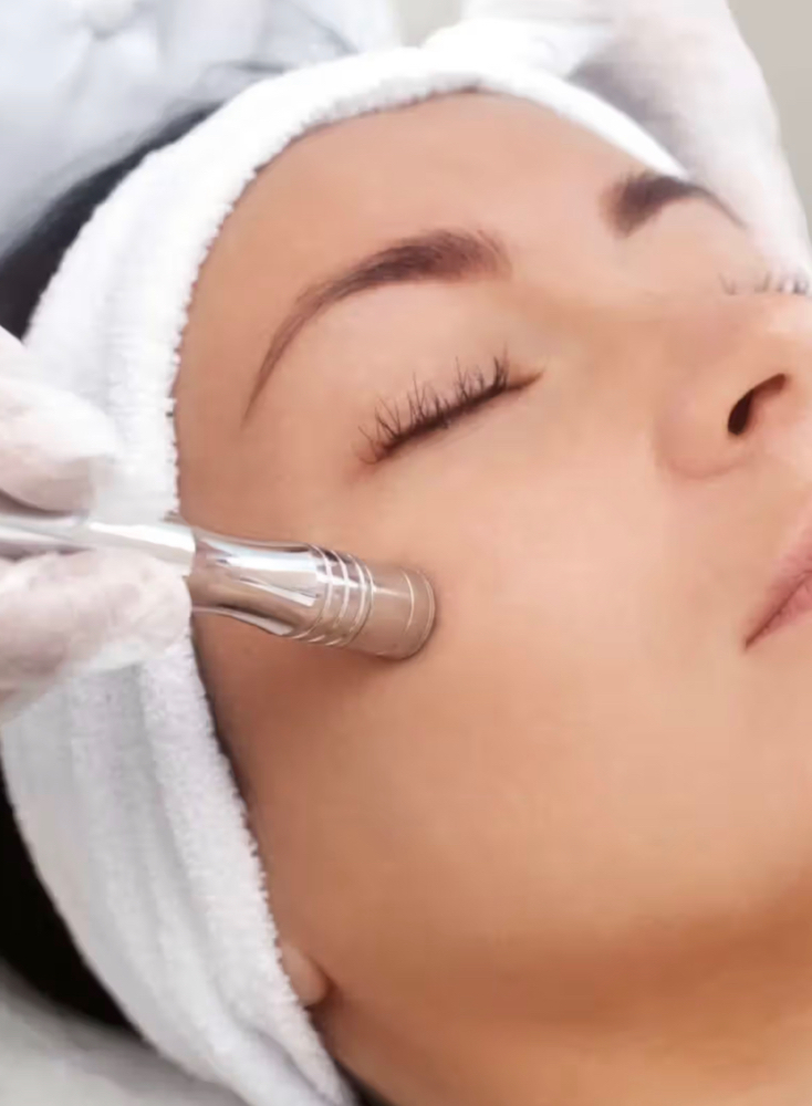 Microdermabrasion Facial