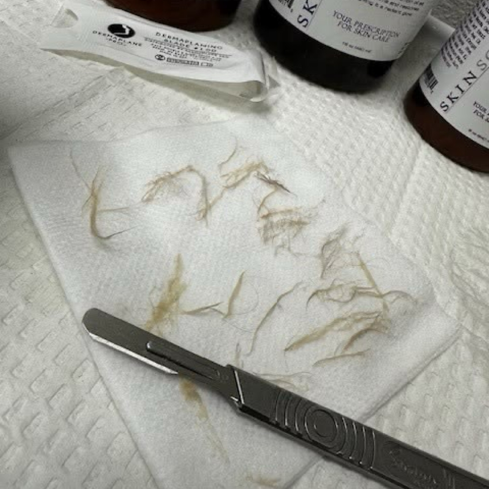 Dermaplaning (ALONE) at TintedCosMedics in Rancho Cucamonga, CA