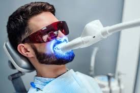 professional teeth whitening