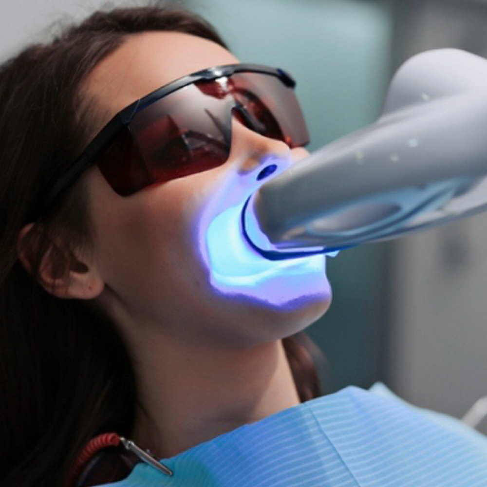 Teeth Withening at Luvlookbeautyspa @GlossGenius in Las Vegas, NV