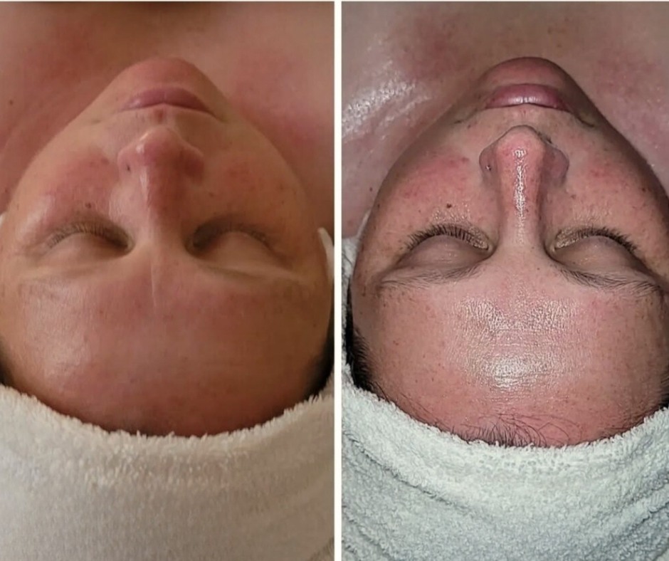 Express Facial