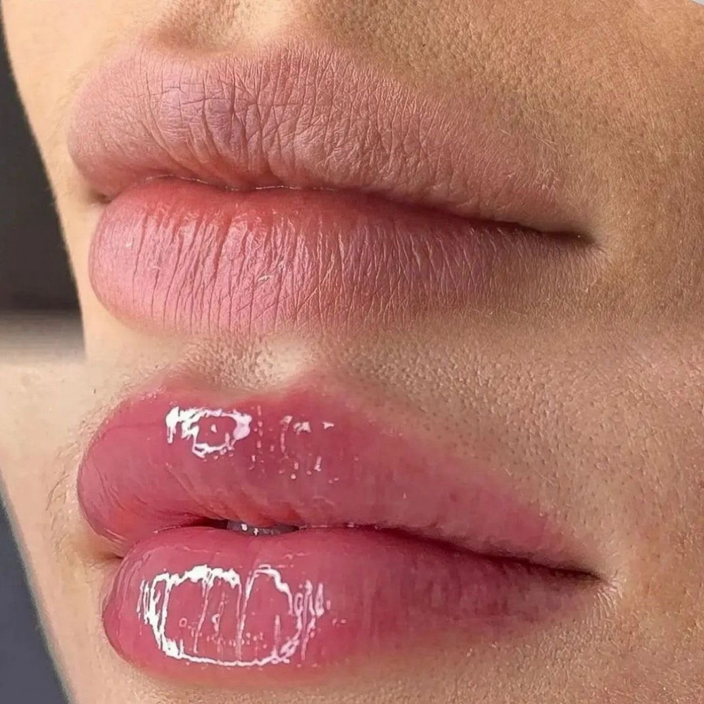 HIDRA LIPS at ROSTRO PERFECTO in Hialeah, FL