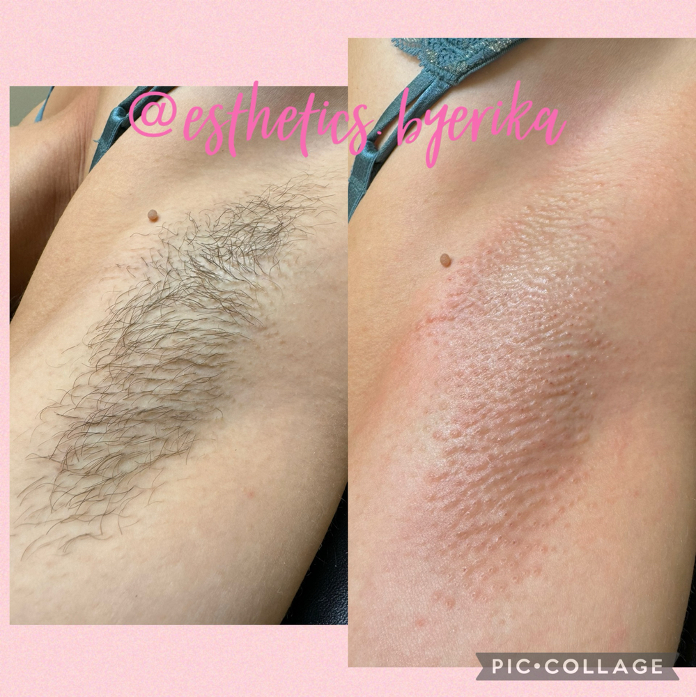 Underarm Wax