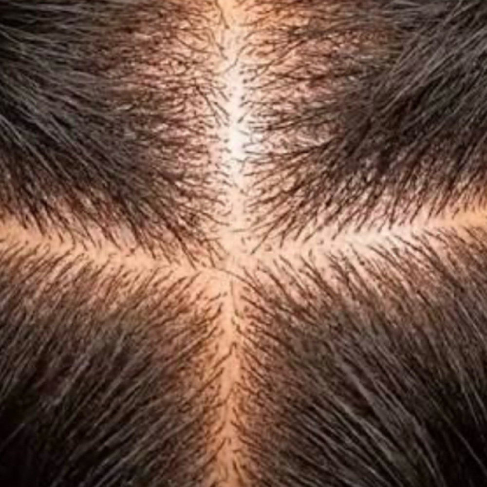 25Step Scalp Circulation Reset at Dailyyy Healing Luxury Mobile Bus Spa Salon in DMV, MD