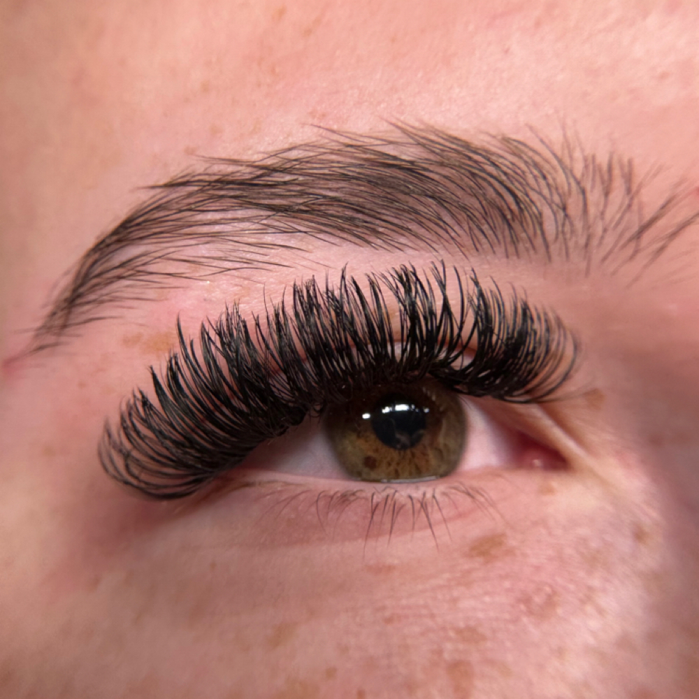 Volume Fill at Zen Esthetics in Greensburg, PA