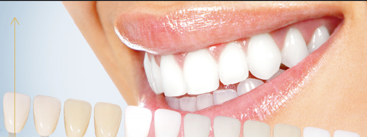 Express Cosmetic Teeth Whitening