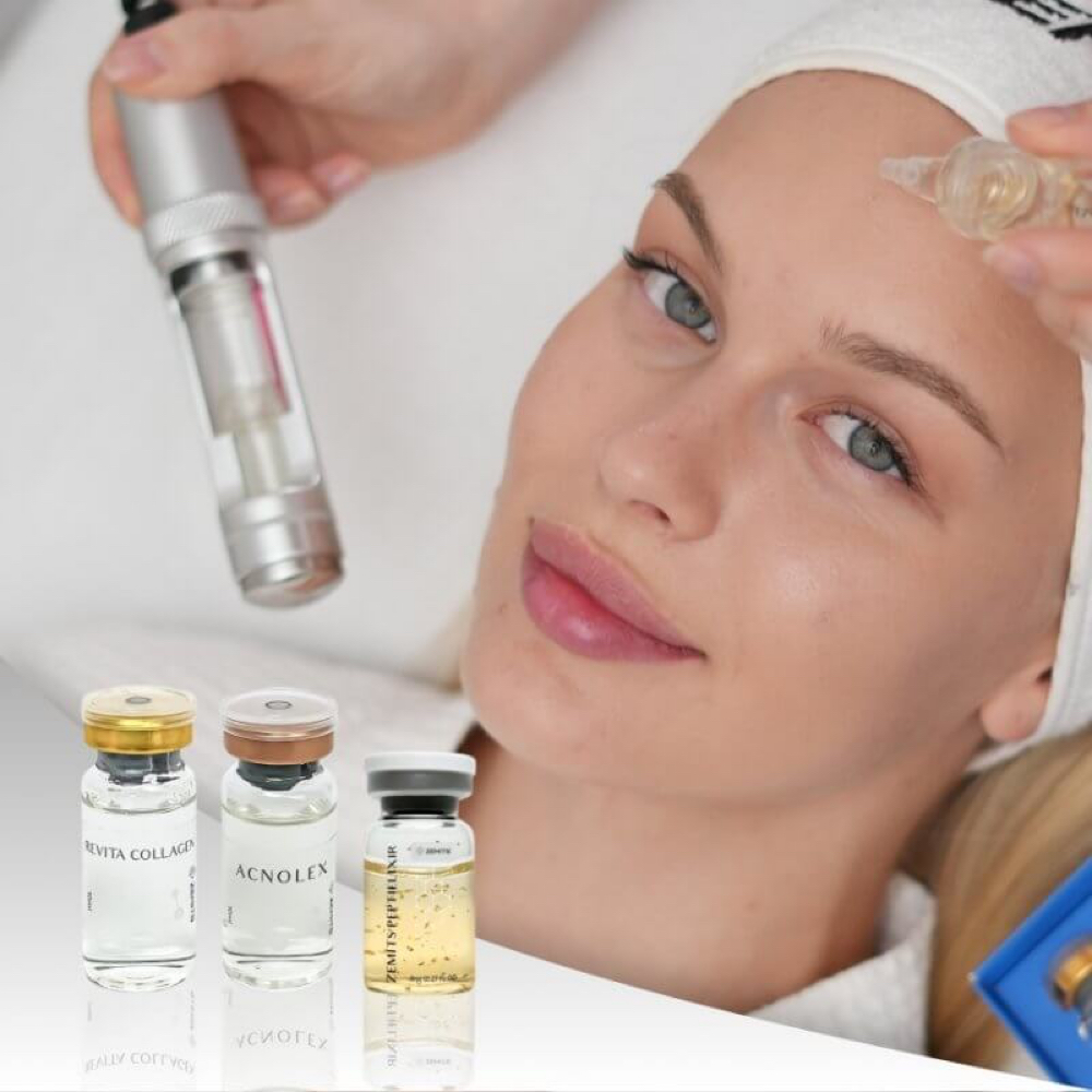 💎 Needle-Free Mesotherapy at Vattskin in Los Ángeles, CA