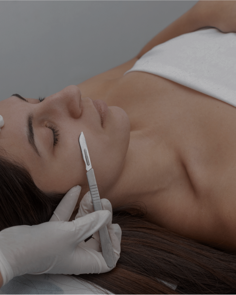 Dermaplaning Treatment