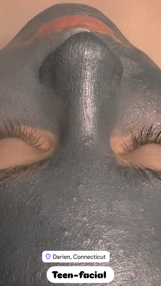 Teen Facial