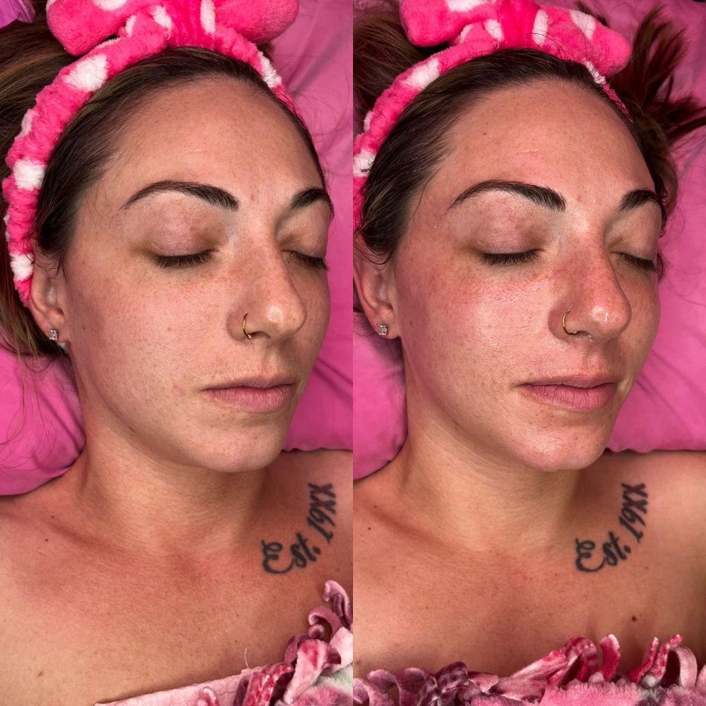 60 min Custom Facial