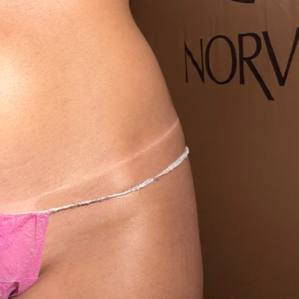 Arabella Glow at Arabella Aesthetics in Johnstown, NY