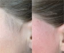 Sideburns wax (patillas)