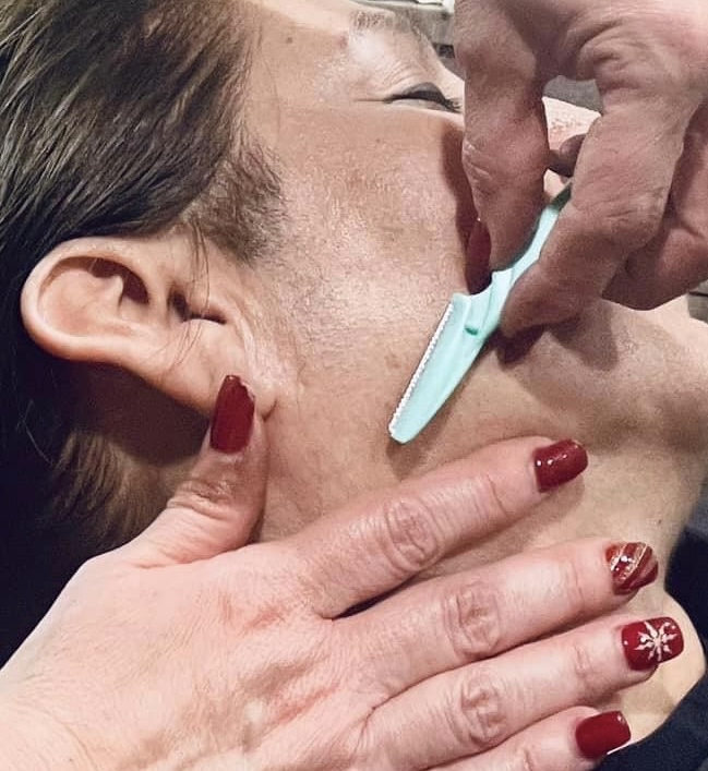 Dermablading